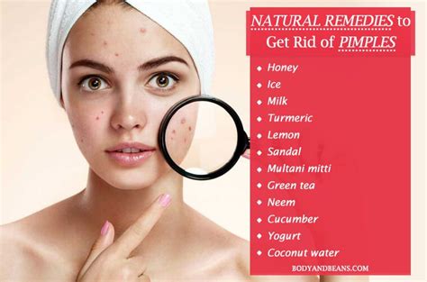 Natural Home Remedies To Get Rid Of Pimples Tired Of Pimples And Want