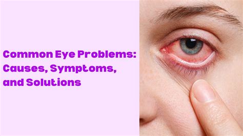 Common Eye Problems Causes Symptoms And Solutions