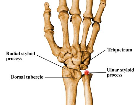 Injury To The Styloid Process