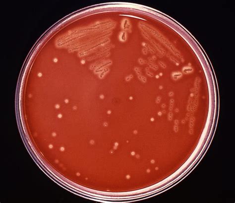 Streptococcus Pyogenes Agentes Biológicos Bacteria