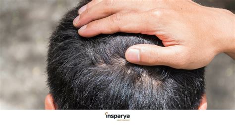 Itchy And Painful Irritated Scalp Solutions Insparya Hair Clinic