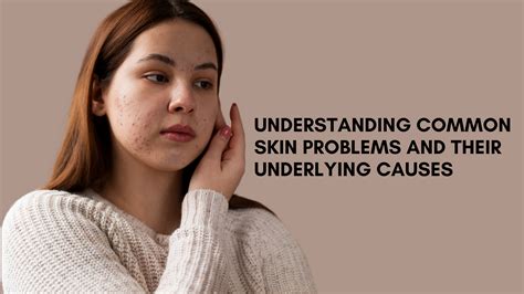 Understanding Common Skin Problems And Their Underlying Causes By