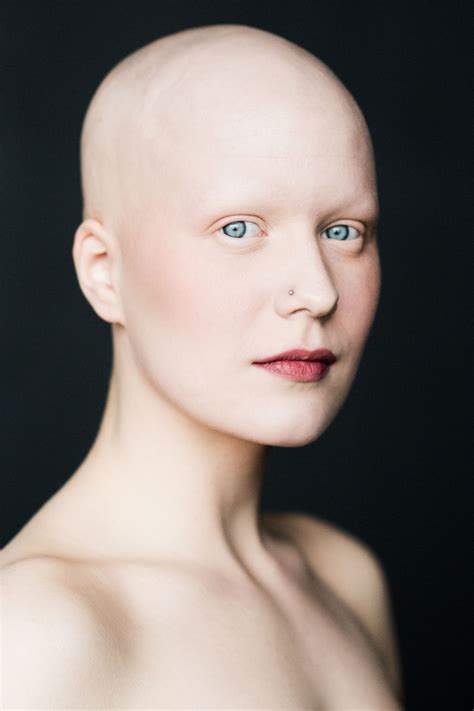 Retratos Impressionantes De Mulheres Alopecia Redefinem A Feminilidade Mdig