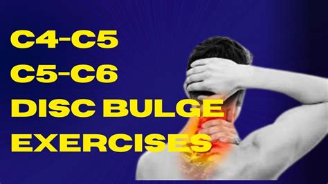 C4 C5 And C5 C6 Disc Bulge Exercises Cervical Spondylitis Exercises