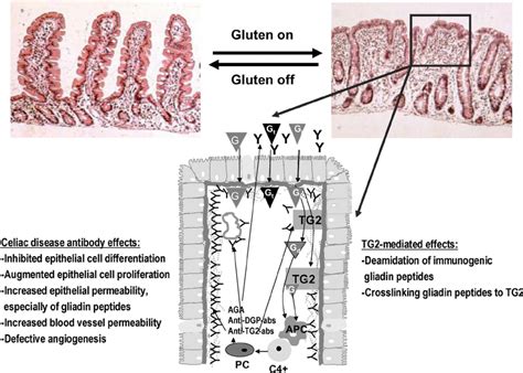 the pathogenesis of celiac disease in celiac disease patients the download scientific diagram