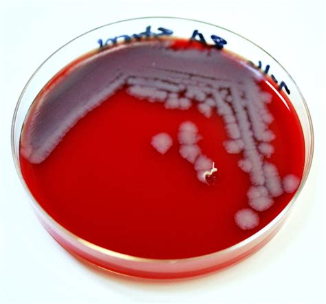 Free Picture Image Bacillus Anthracis Bacteria Colonies
