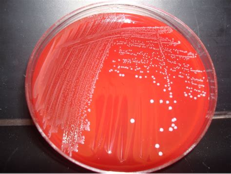 Alpha And Beta Hemolytic Streptococcus Red Mountain Microbiology