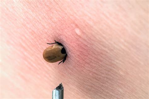 Ticks Guide How To Prevent And Treat Tick Bites Bbc Countryfile