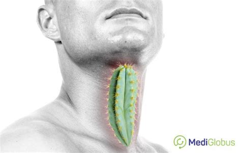 Throat Cancer Surgery Medical Tourism With Mediglobus The Best