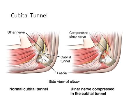 Ulnar Nerve Anatomy Its Lesions Dr Mukesh Singla