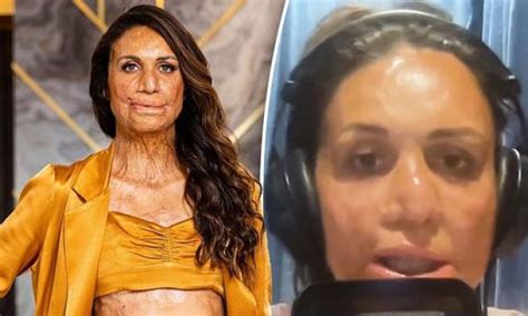 Inspirational Burns Survivor Turia Pitt Opens Up On The Confronting Moment She Found Pictures
