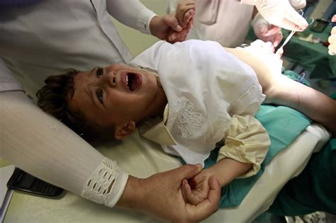 Fewer circumcisions could cost the US billions study августа