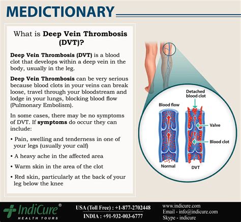 Dvt Is A Major Risk Associated With Surgery This Is Especially True If