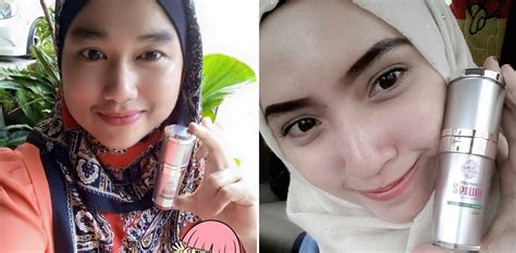 Produk mederma ag merupakan antara produk kecantikan terbaik memberikan manfaat pengelupasan asid glikolik dalam sistem pembersihan dan pelembapan yang seimbang dengan ph untuk seluruh badan. 5 Produk Kecantikan Murah,Selamat Dan Terlaris Di Malaysia ...