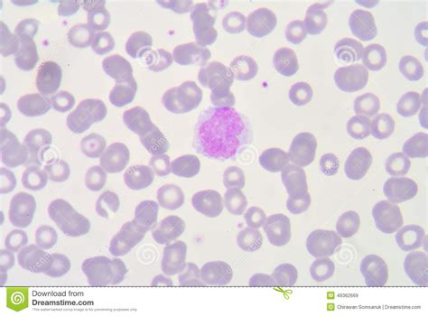 Monocyte Stock Image Image Of Microcyte Biology Medical 49362669