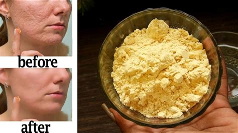 Everyday Besan Face Pack For Healthy Glowing Skin Besan Sandalwood