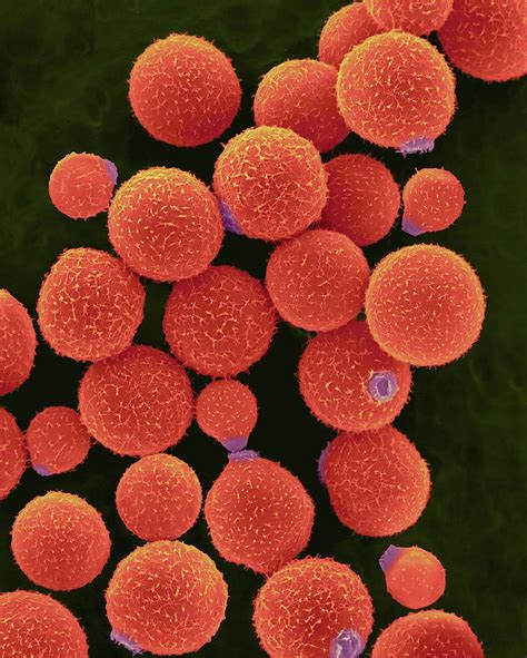 Cryptococcus Neoformans Photograph By Dennis Kunkel Microscopyscience
