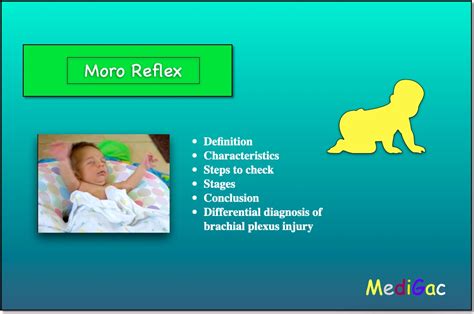 How To Check Moro Reflex In Newborn Babies Medigac