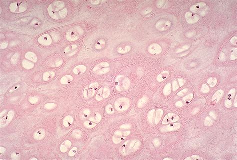 Medical Pictures Info Hyaline Cartilage