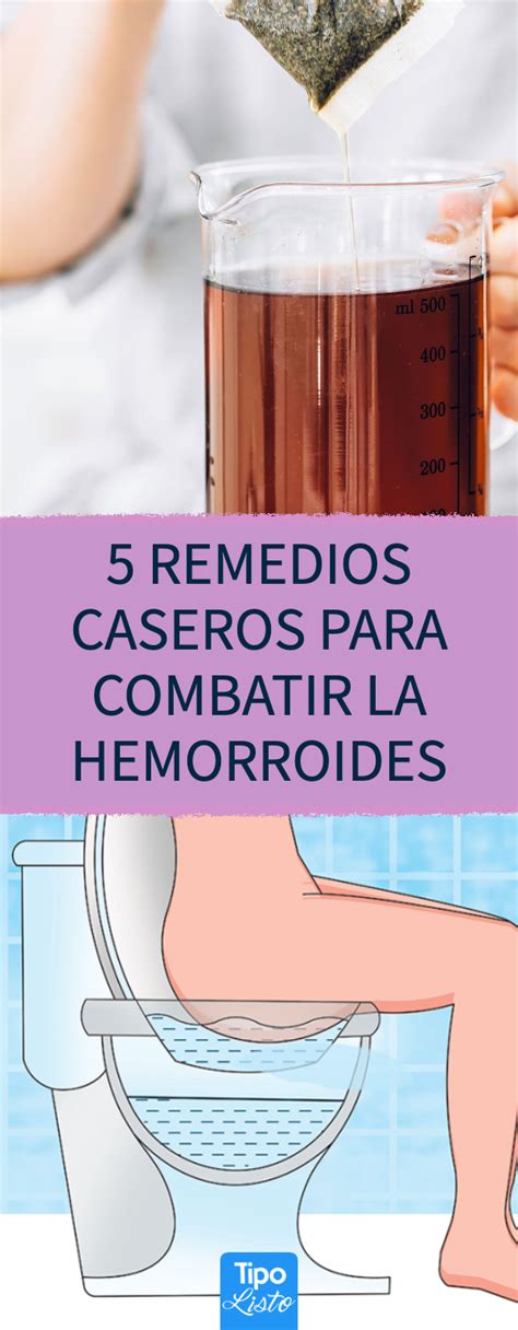 Hemorroides Remedios Caseros Remedios Efectivos Que Debes Probar The Best Porn Website