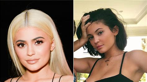 Kylie Jenner Removed Her Lip Filler Teen Vogue