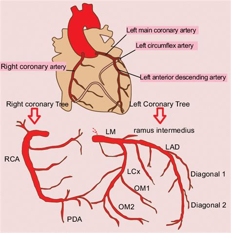 The two exceptions are the pulmonary and the umbilical arteries. Right and left coronary trees. LAD: left anterior descending artery;... | Download Scientific ...