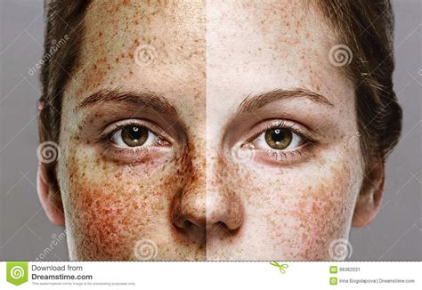 Eyes Woman Freckle Happy Young Beautiful Studio Portrait With Healthy