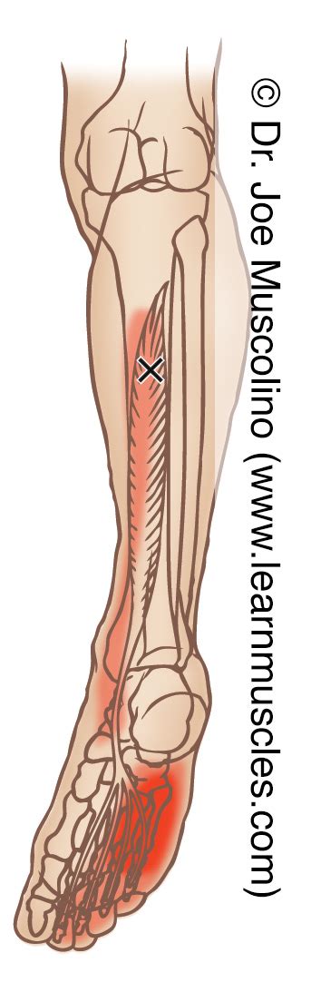 Flexor Digitorum Longus Dick Trigger Points Learn Muscles