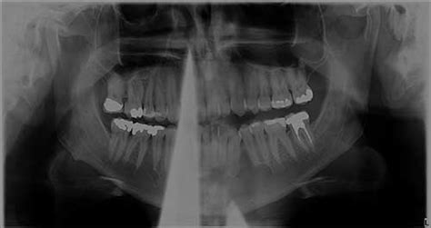 Com January 2018 Uw School Of Dentistry