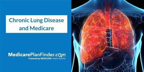 The Ultimate Guide To Medicare Chronic Lung Disease Coverage