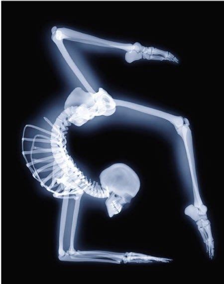 250 x ray ideen in 2021 röntgenbilder röntgen nacktscanner