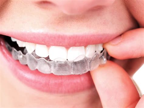 The Benefits Of Invisalign For Adults In Chandler Az Invisalign