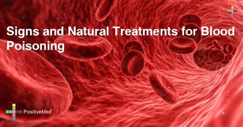 Signs And Natural Treatments For Blood Poisoning Positivemed