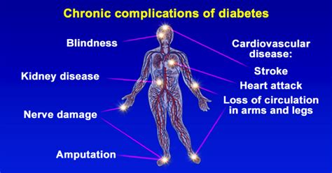 Chronic Complications Of Diabetes ~ Heal Diabetes