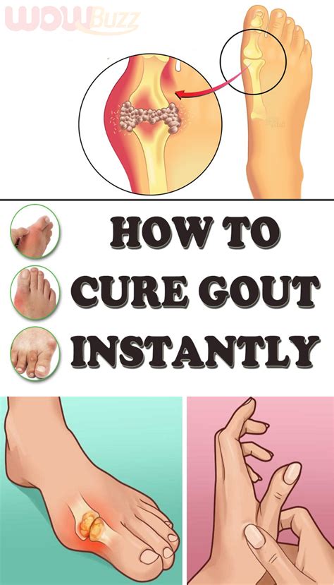 Do Antioxidants Help With Gout Whatodi