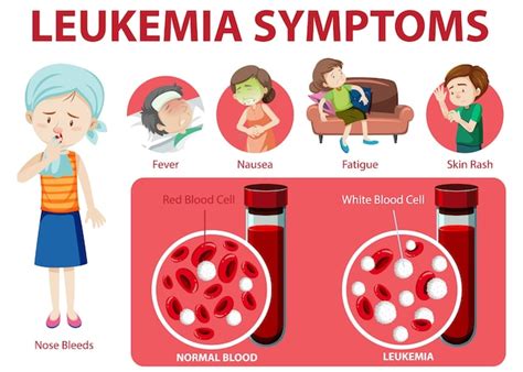 Free Vector Leukemia Symptoms Cartoon Style Infographic