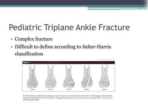 Ppt The Pediatric Triplane Ankle Fracture Powerpoint Presentation