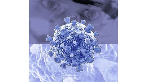 Oxford Immunotec Releases The T Spot Discovery Sars Cov 2 Kit