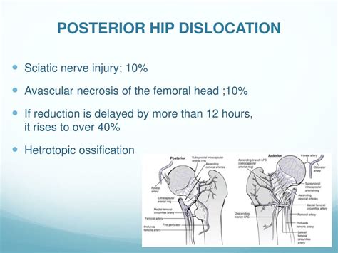 Ppt Acute Joint Dislocation Powerpoint Presentation Free Download