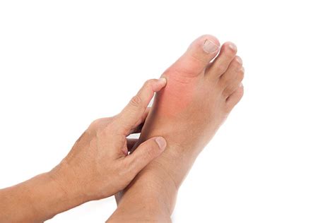 Gout Foot And Ankle Institute Of The West