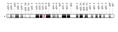 Partial Tetrasomy 6p Comparable To Trisomy Distal 6p Phenotype