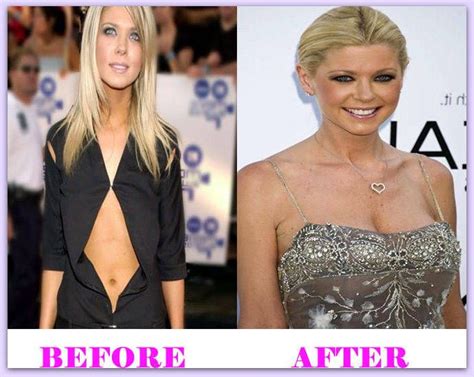 Tara Reid Plastic Surgery Before And After Tarareidplasticsurgery Tarareid
