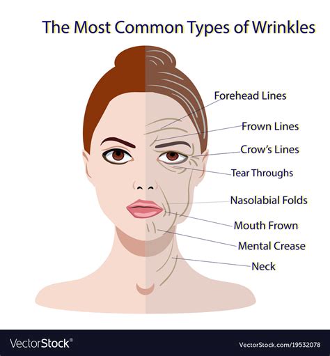 Common Types Facial Wrinkles Cosmetic Surgery Vector Image