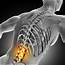 Lower Back And Spine Pain  Causes Treatment In Edison New