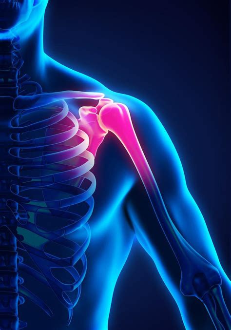 5 Conditions That Cause Lasting Shoulder Pain James A Nassiri Md Ma