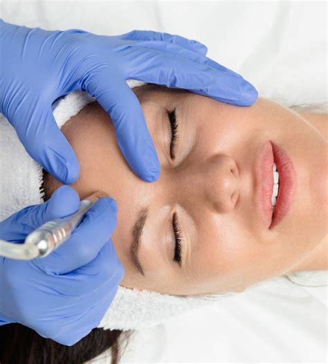 Microdermabrasion Rancho Cucamonga Perfect Image Med Spa