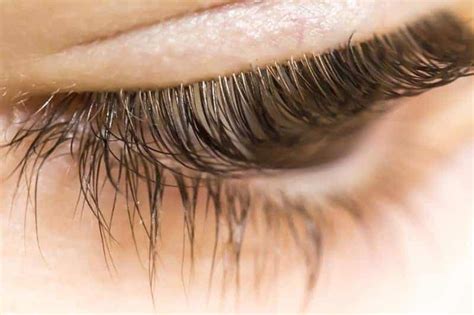 25 Images Eyelash Mite Removal Demodectic Mange