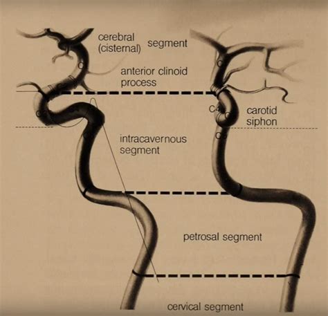 Pin By Shawn Kelly Hurley On Endovascular Arteries Anatomy Medical