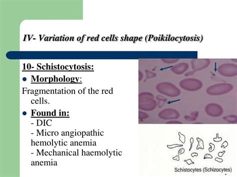 Ppt Rbcs Abnormal Morphology Powerpoint Presentation Free Download