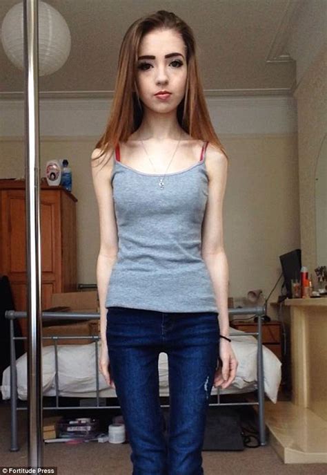 Anorexic Teenager Hollie Faye Cullen Lived Off Six Cups Of Tea A Day Daily Mail Online